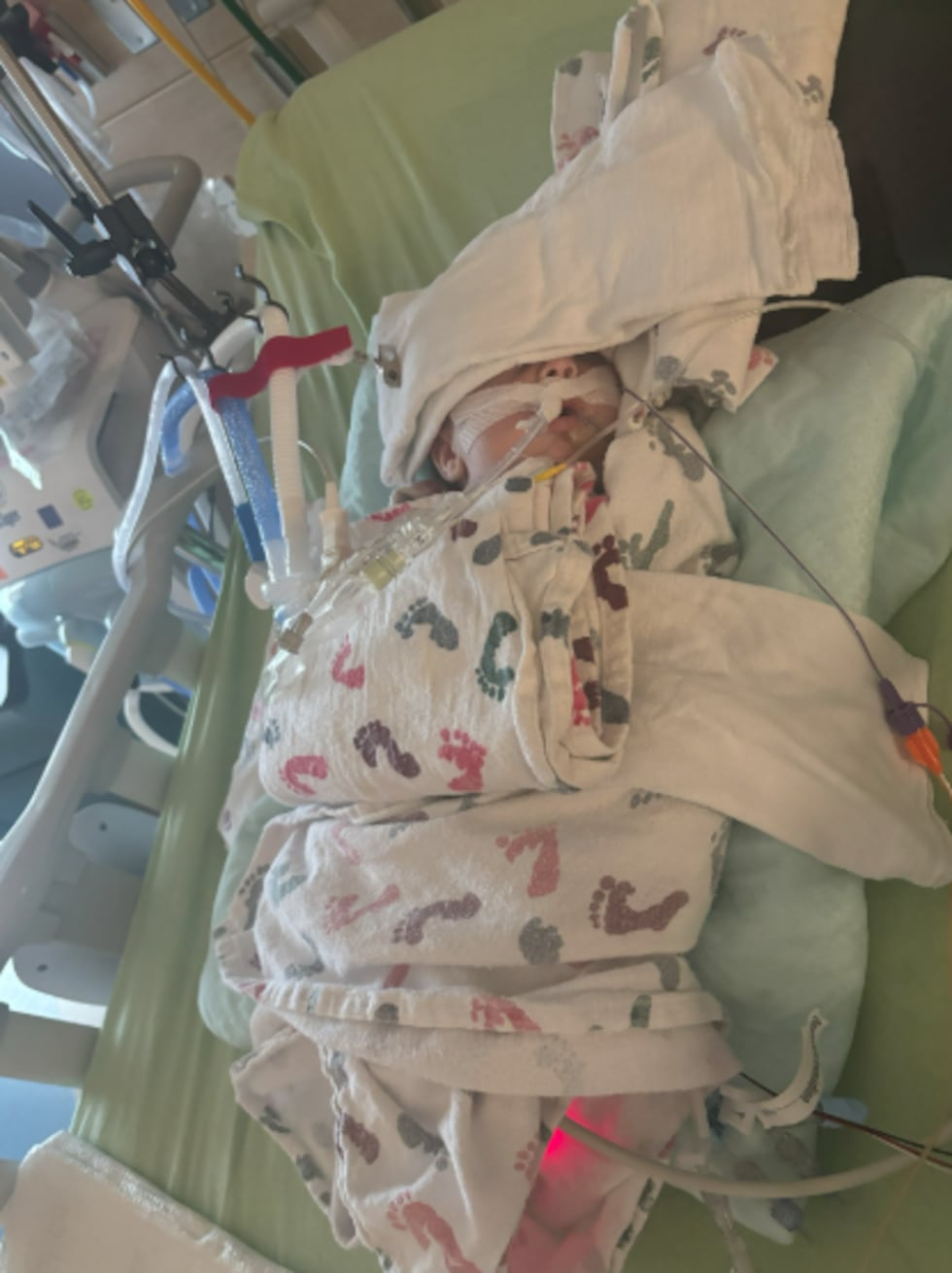Mason's parents knew right away something was off with Mason's breathing after he was born.