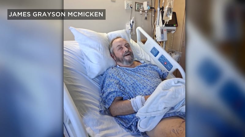 James Grayson McMicken, 71, is lucky to be alive after an alligator attack turned a quiet...