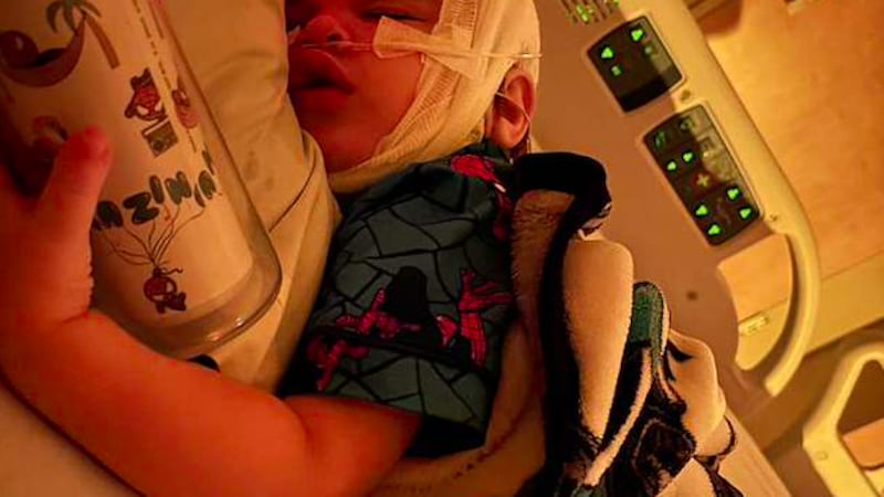 Two-year-old Mason Dixon has a rare birth defect called pyriform aperture stenosis.